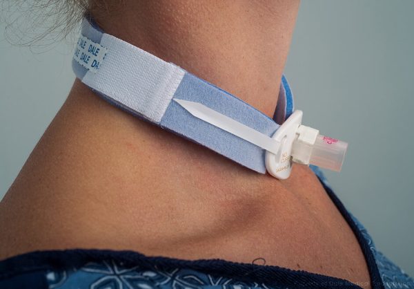 CURSO MANEJO DE TRAQUEOSTOMÍA (MUY PRONTO)